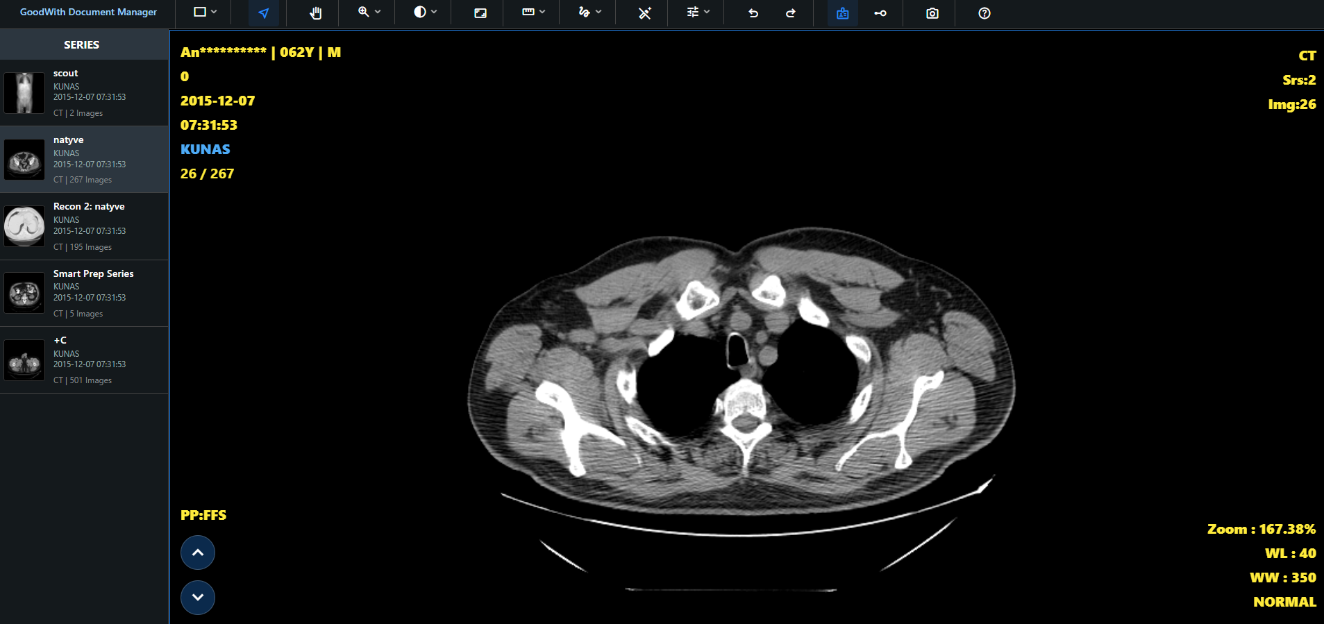 DICOM Viewer 화면
