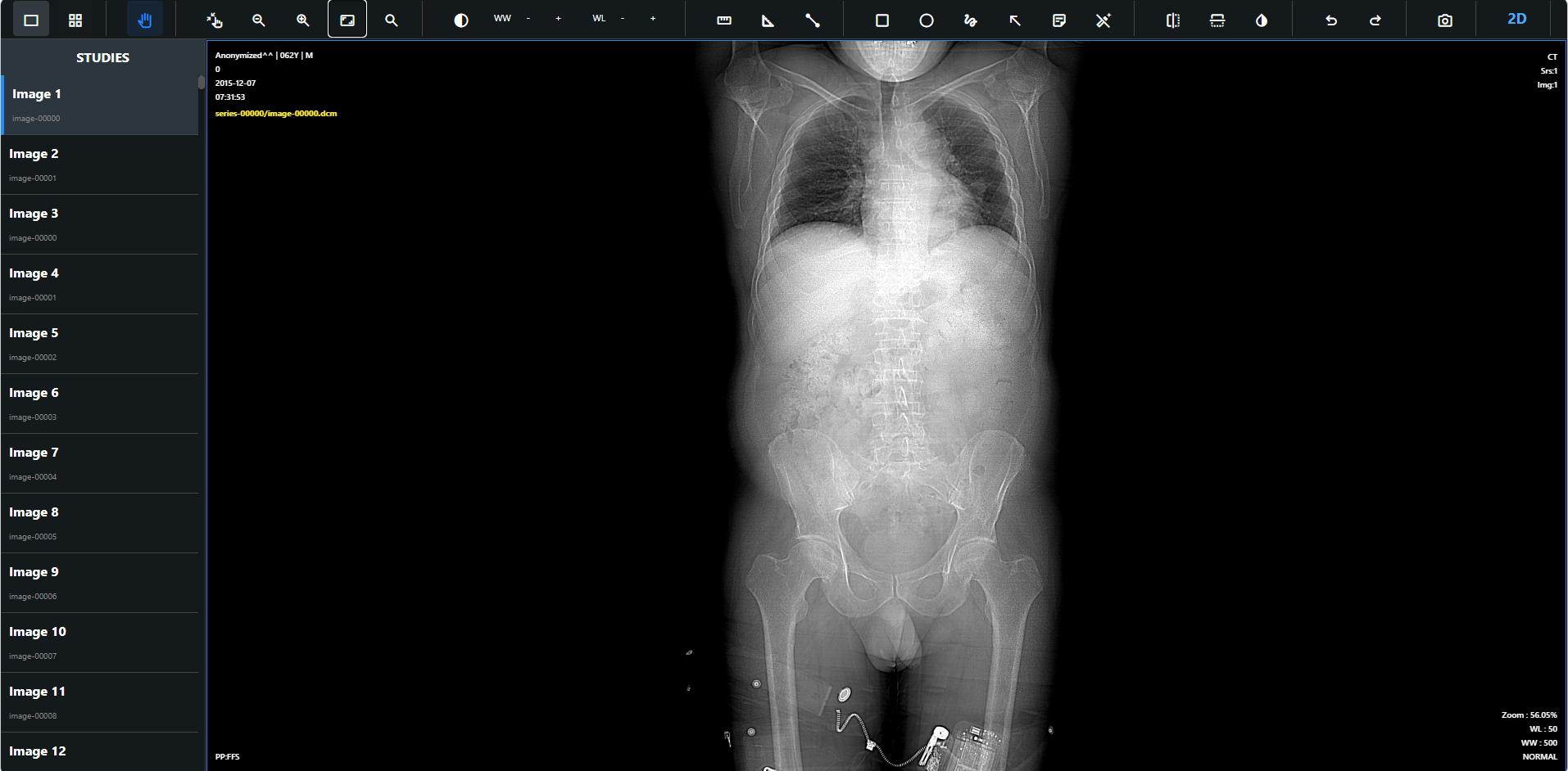 DICOM Viewer Interface 1