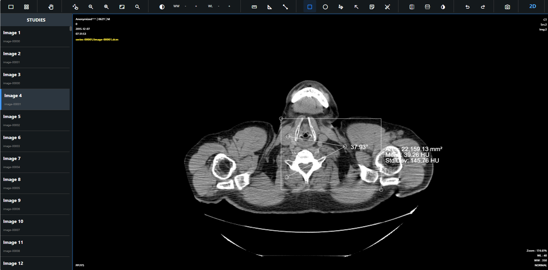 DICOM Viewer Interface 2