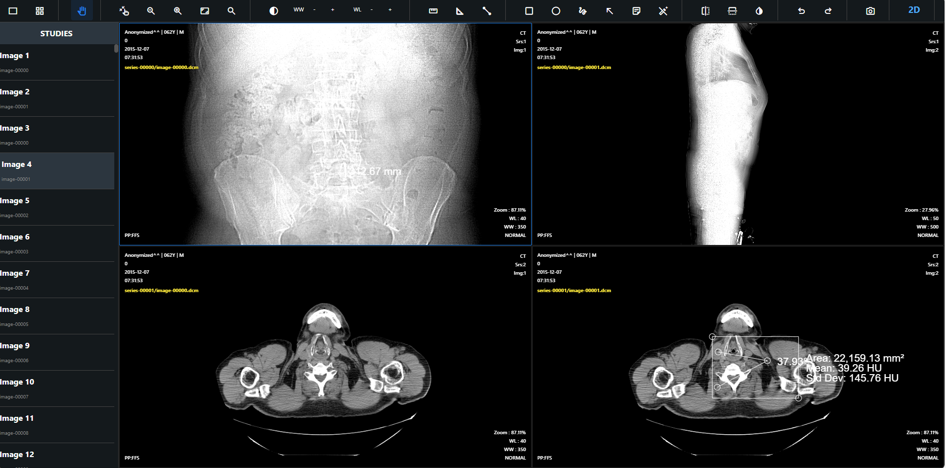 DICOM Viewer Interface 3
