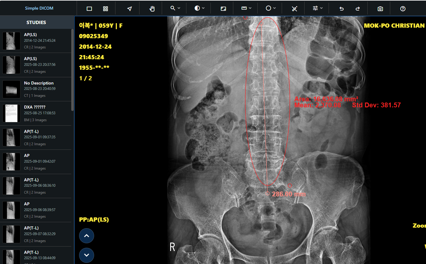 사건 의료 영상을 브라우저에서 바로 보는 SONSA ON DICOM 뷰어
